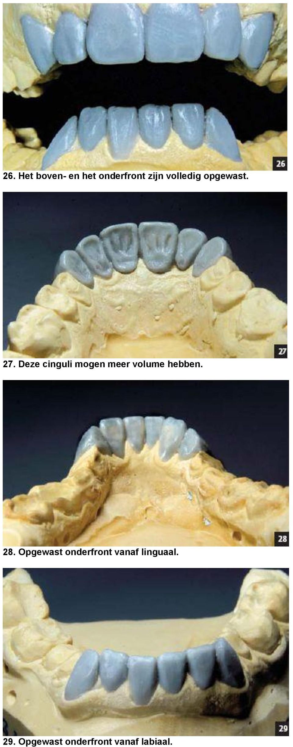 Deze cinguli mogen meer volume hebben. 28.