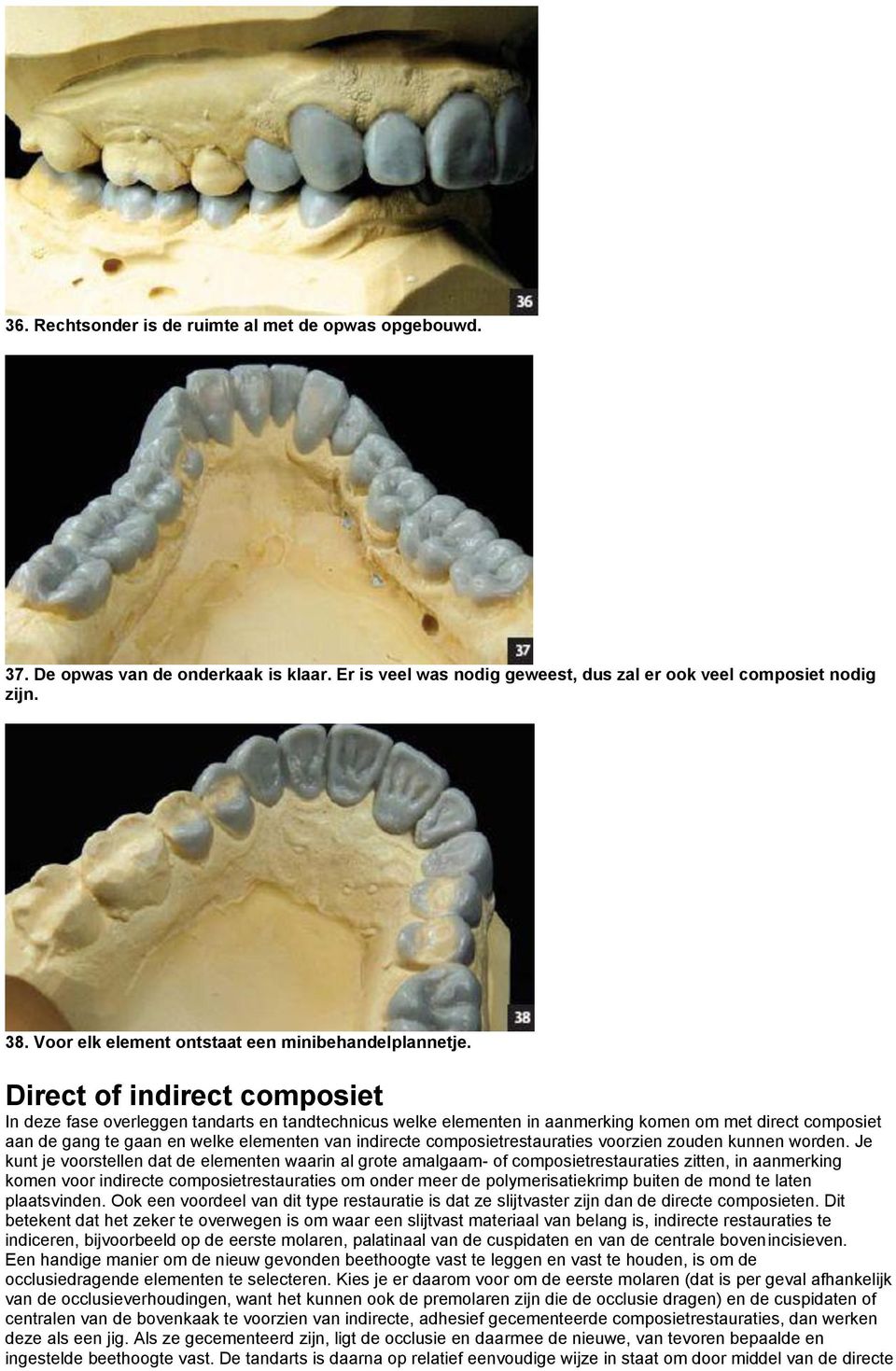 Direct of indirect composiet In deze fase overleggen tandarts en tandtechnicus welke elementen in aanmerking komen om met direct composiet aan de gang te gaan en welke elementen van indirecte