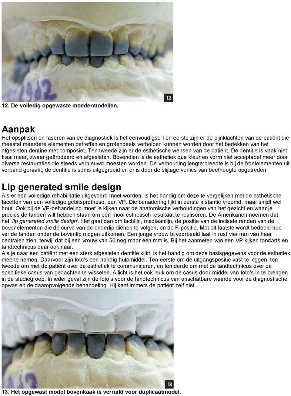 Ten tweede zijn er de esthetische wensen van de patiënt. De dentitie is vaak niet fraai meer, zwaar geërodeerd en afgesleten.