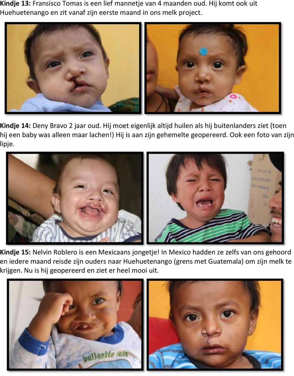 ) Hij is aan zijn gehemelte geopereerd. Ook een foto van zijn lipje. Kindje 15: Nelvin Roblero is een Mexicaans jongetje!
