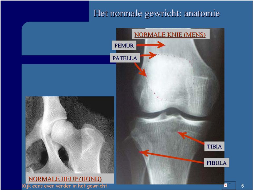 NORMALE KNIE (MENS)