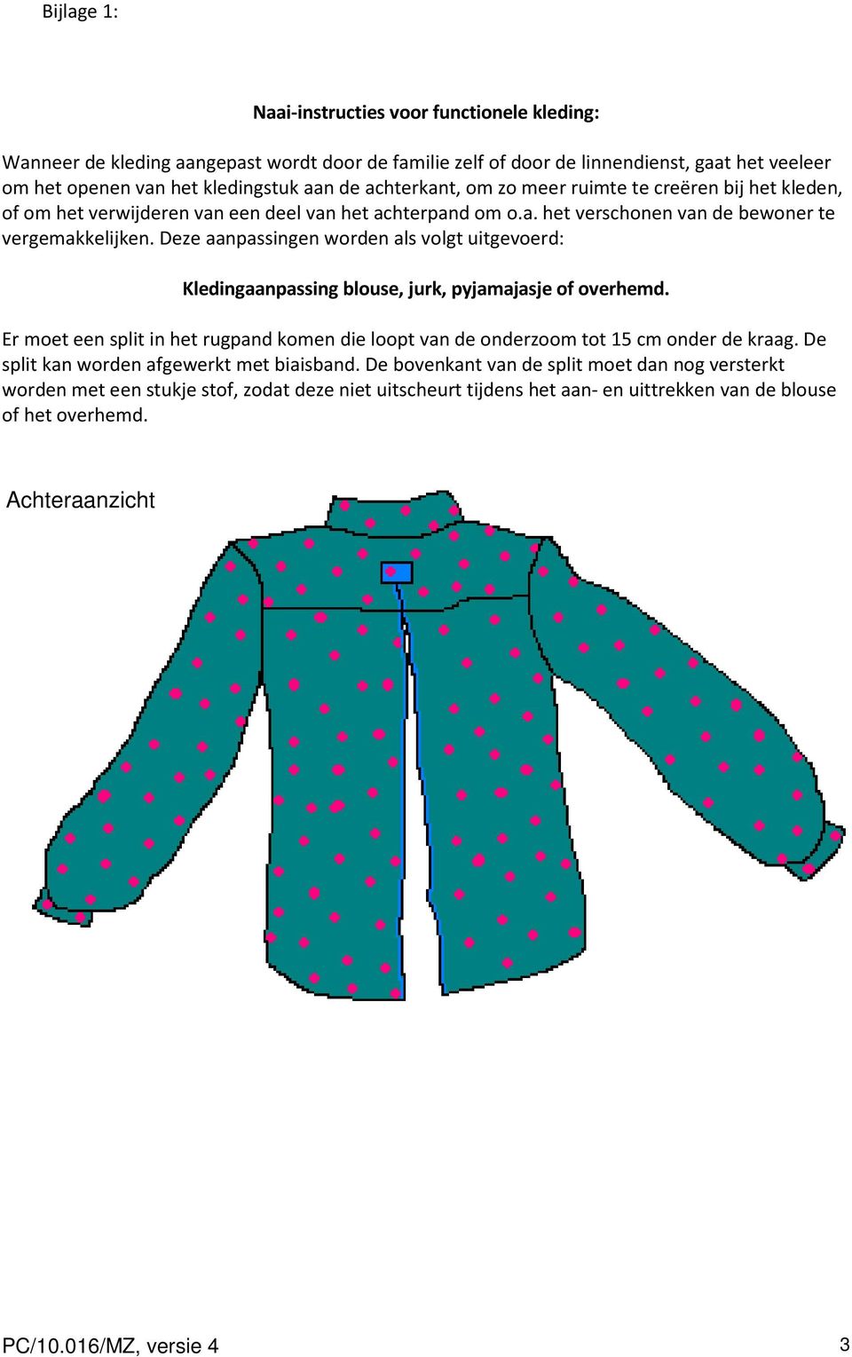 Deze aanpassingen worden als volgt uitgevoerd: Kledingaanpassing blouse, jurk, pyjamajasje of overhemd. Er moet een split in het rugpand komen die loopt van de onderzoom tot 15 cm onder de kraag.