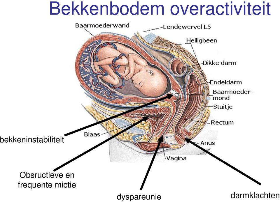 bekkeninstabiliteit