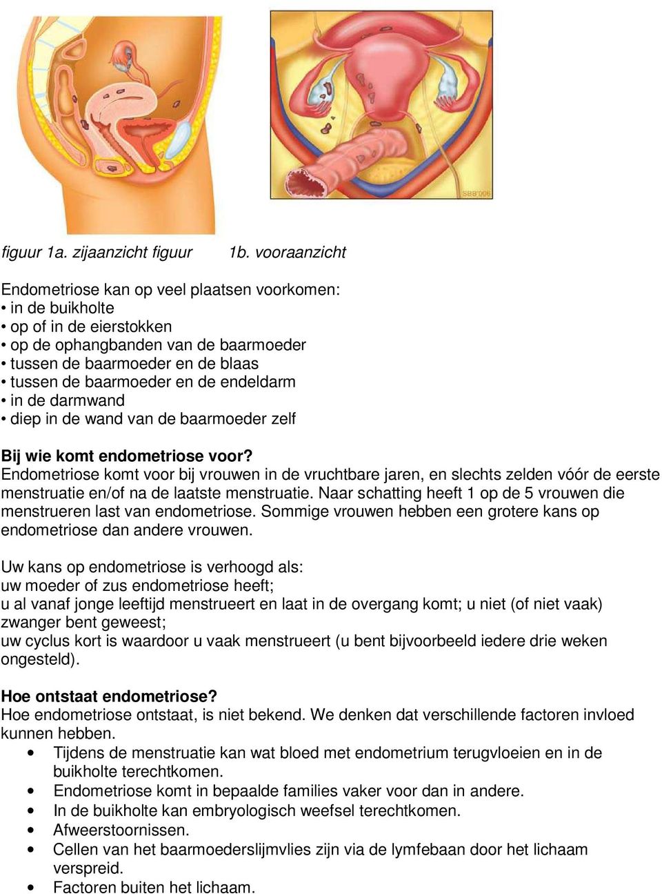 endeldarm in de darmwand diep in de wand van de baarmoeder zelf Bij wie komt endometriose voor?