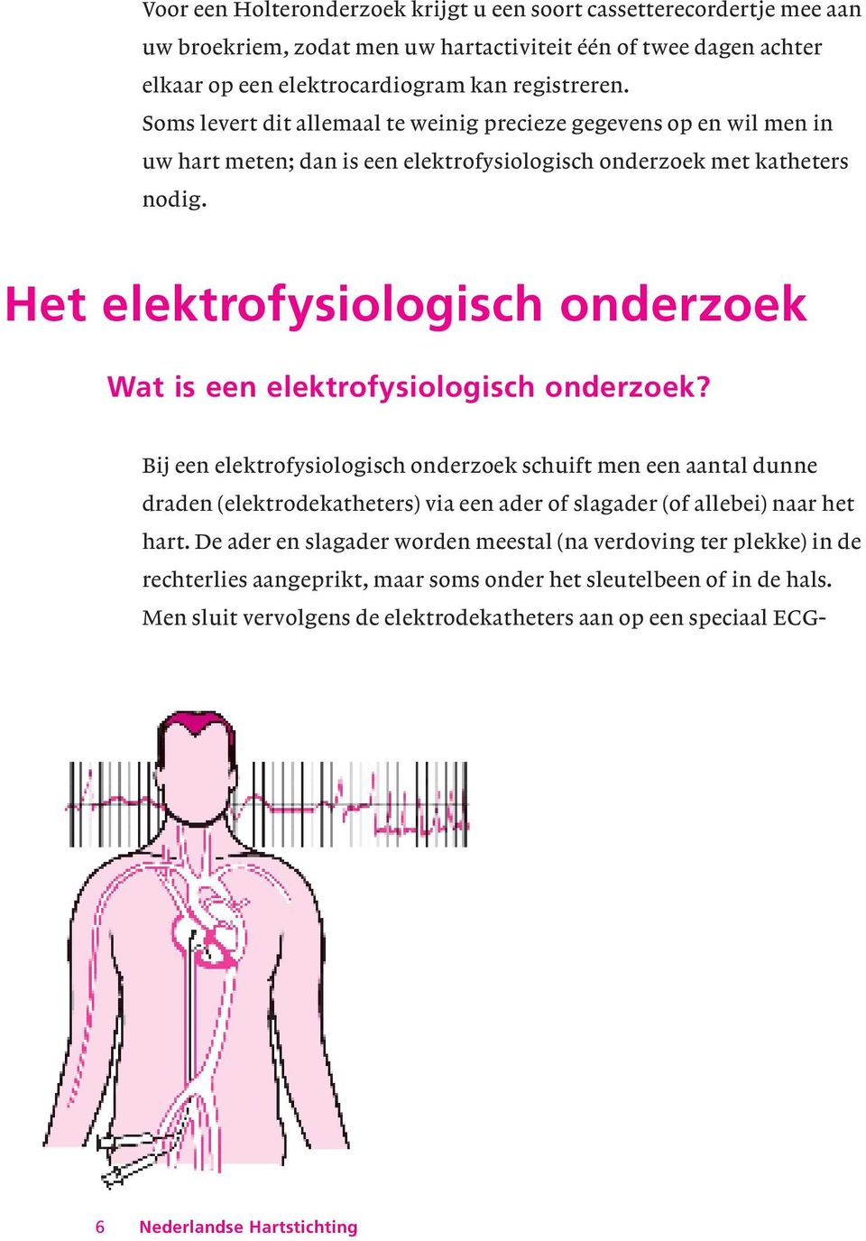 Het elektrofysiologisch onderzoek Wat is een elektrofysiologisch onderzoek?