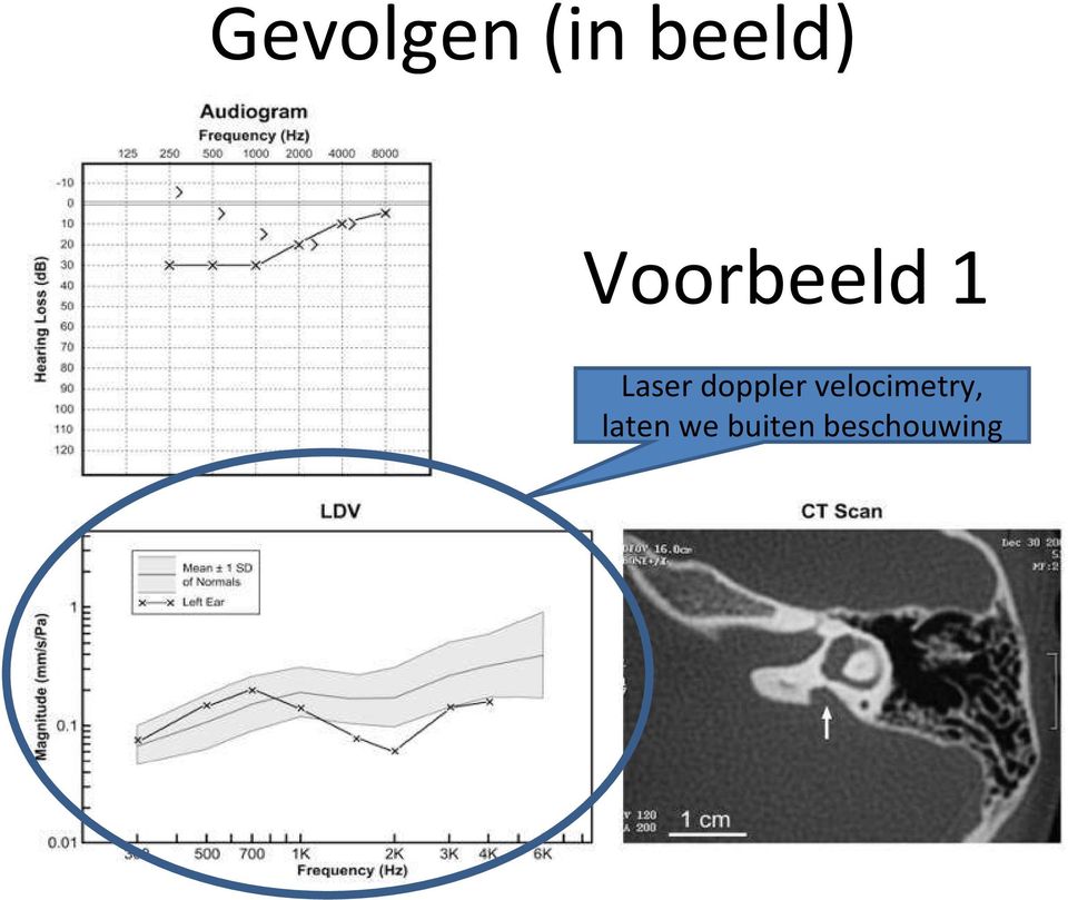 doppler velocimetry,