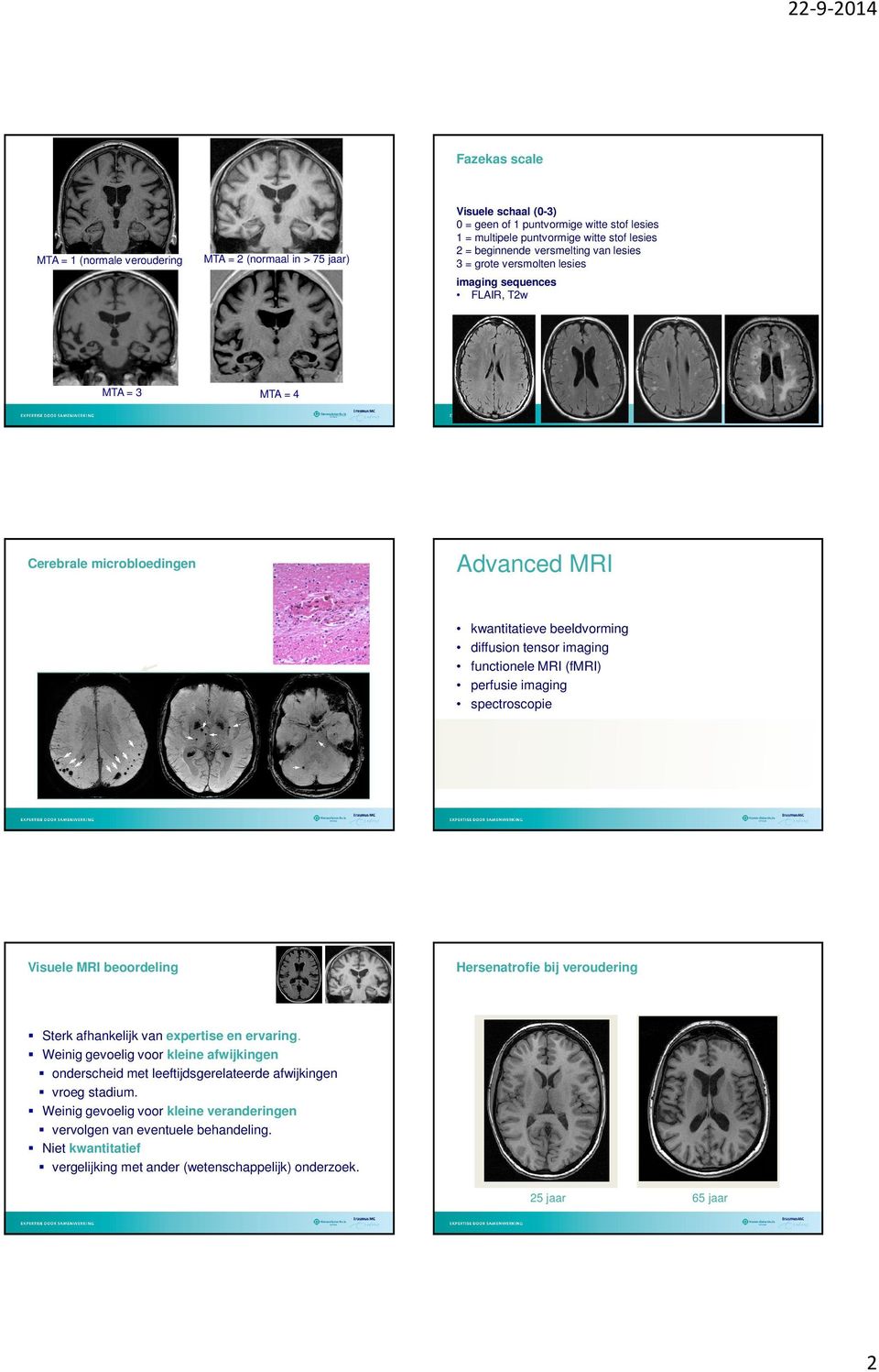 imaging functionele MI (fmi) perfusie imaging spectroscopie Hersenatrofie bij veroudering Sterk afhankelijk van expertise en ervaring.