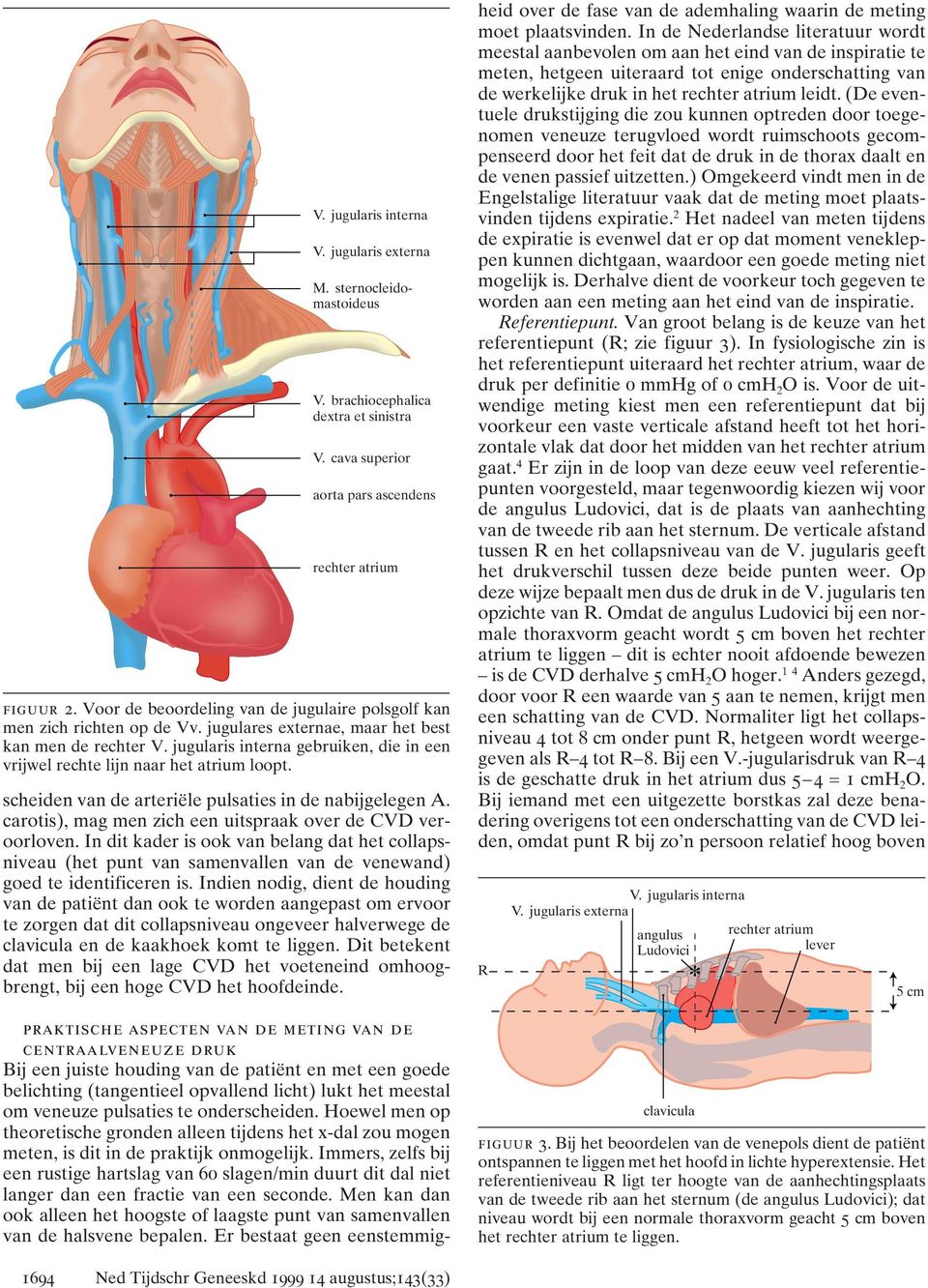 jugularis interna gebruiken, die in een vrijwel rechte lijn naar het atrium loopt. scheiden van de arteriële pulsaties in de nabijgelegen A.