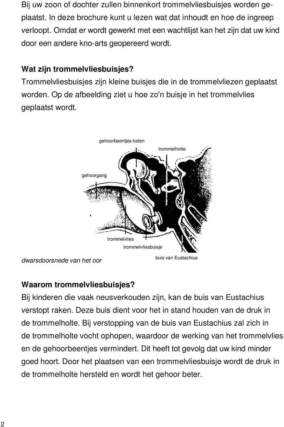 Trommelvliesbuisjes zijn kleine buisjes die in de trommelvliezen geplaatst worden. Op de afbeelding ziet u hoe zo'n buisje in het trommelvlies geplaatst wordt.