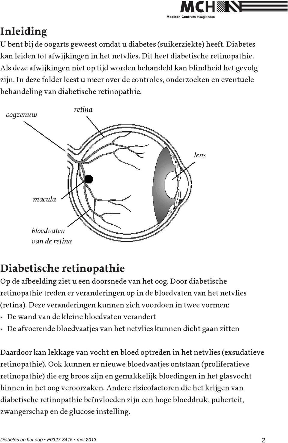 oogzenuw retina lens macula bloedvaten van de retina Diabetische retinopathie Op de afbeelding ziet u een doorsnede van het oog.