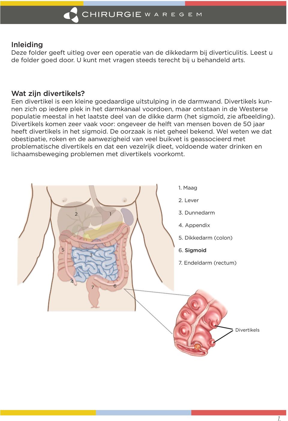 Divertikels kunnen zich op iedere plek in het darmkanaal voordoen, maar ontstaan in de Westerse populatie meestal in het laatste deel van de dikke darm (het sigmoïd, zie afbeelding).