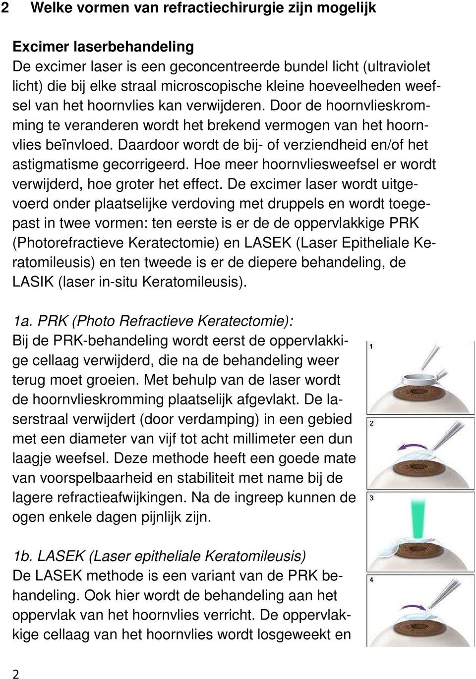 Daardoor wordt de bij- of verziendheid en/of het astigmatisme gecorrigeerd. Hoe meer hoornvliesweefsel er wordt verwijderd, hoe groter het effect.