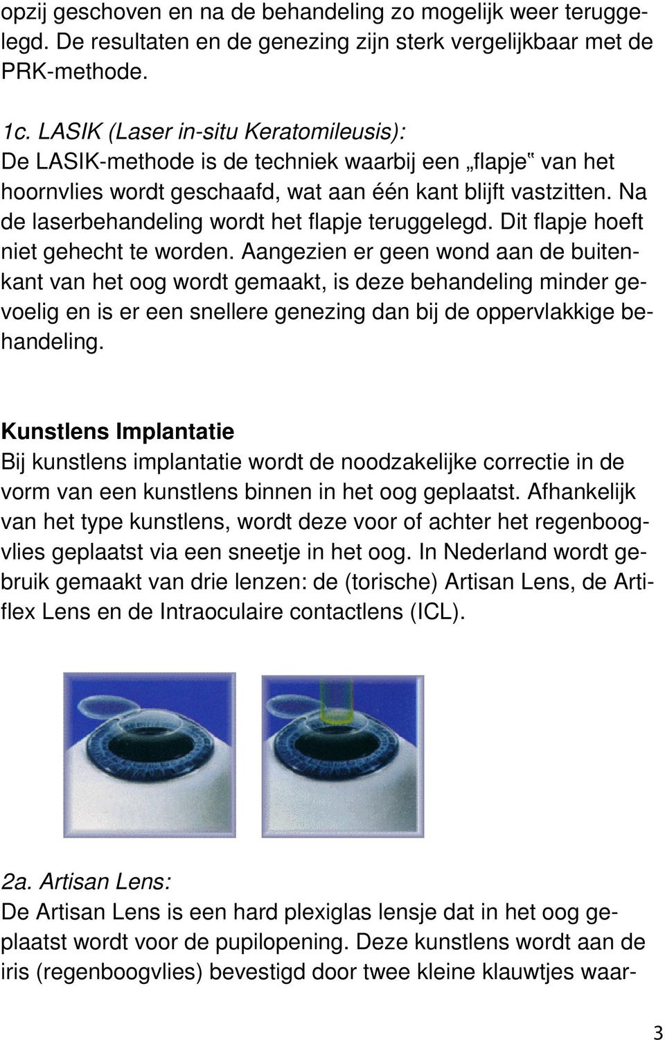 Na de laserbehandeling wordt het flapje teruggelegd. Dit flapje hoeft niet gehecht te worden.