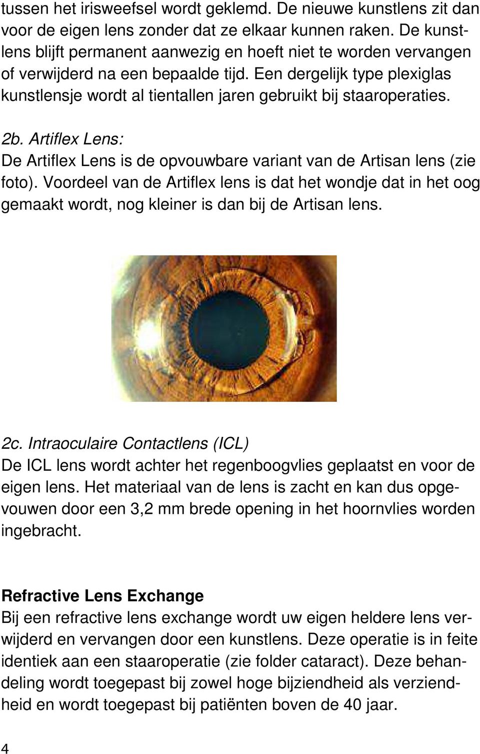 Een dergelijk type plexiglas kunstlensje wordt al tientallen jaren gebruikt bij staaroperaties. 2b. Artiflex Lens: De Artiflex Lens is de opvouwbare variant van de Artisan lens (zie foto).