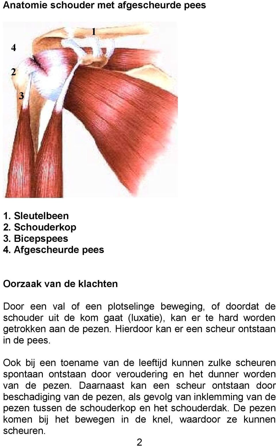 aan de pezen. Hierdoor kan er een scheur ontstaan in de pees.