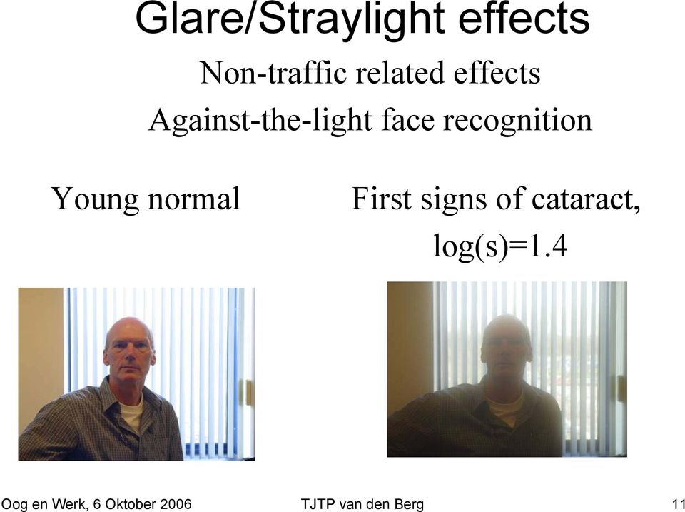 Young normal First signs of cataract, log(s)=1.