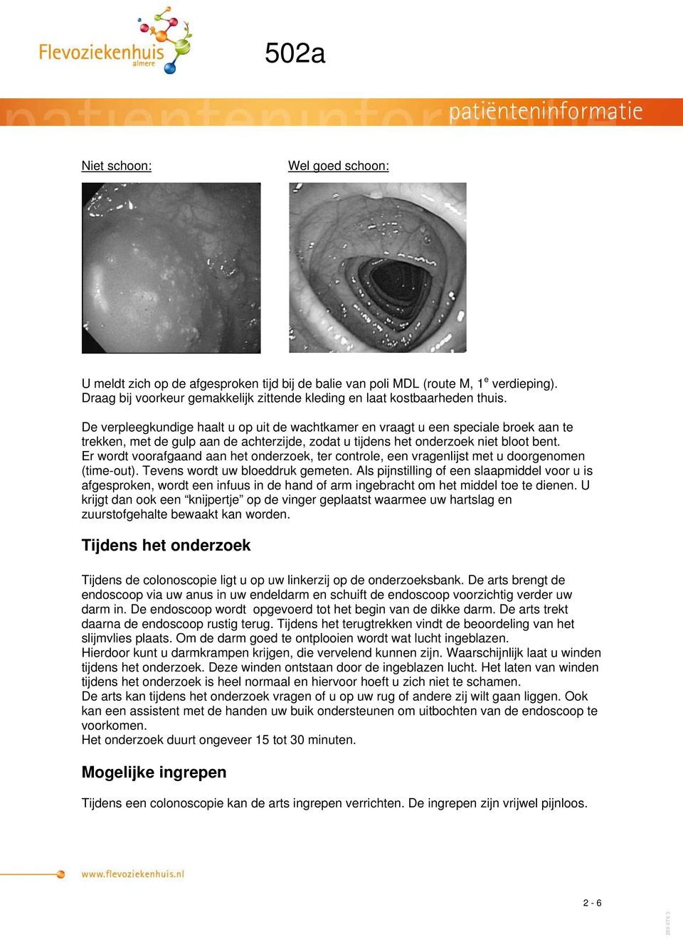 Er wordt voorafgaand aan het onderzoek, ter controle, een vragenlijst met u doorgenomen (time-out). Tevens wordt uw bloeddruk gemeten.