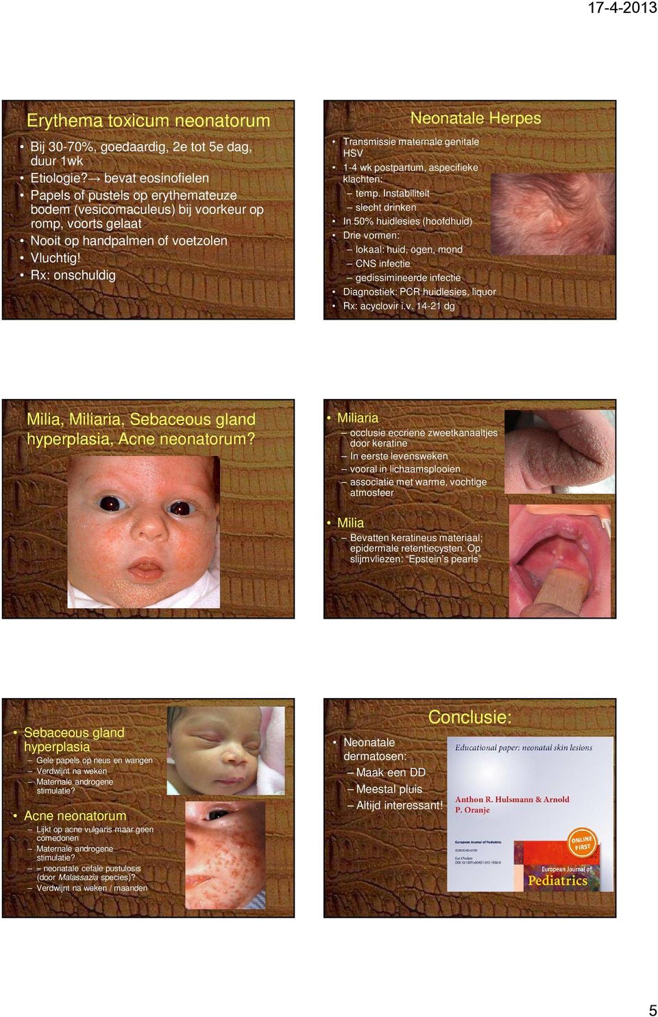 x: onschuldig Neonatale Herpes Transmissie maternale genitale HSV 1-4 wk postpartum, aspecifieke klachten: temp.