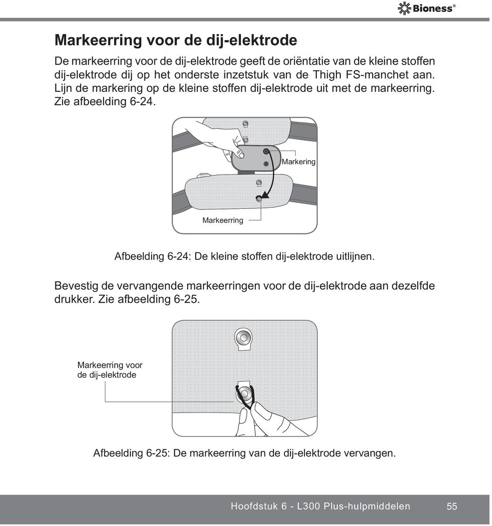 Markering Markeerring Afbeelding 6-24: De kleine stoffen dij-elektrode uitlijnen.