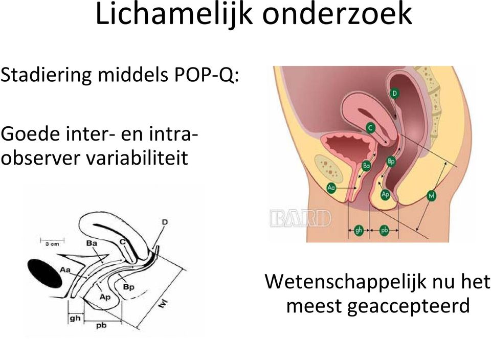 intraobserver variabiliteit