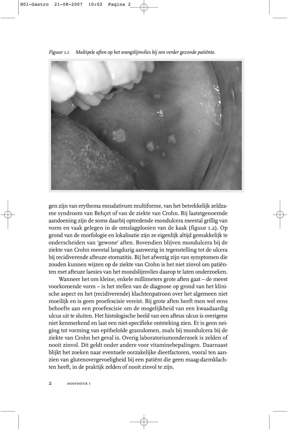 Bij laatstgenoemde aandoening zijn de soms daarbij optredende mondulcera meestal grillig van vorm en vaak gelegen in de omslagplooien van de kaak (figuur 1.2).