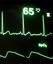 Hartfunctielaborant Intro Bekijk het filmpje: Een hartfunctie laborant werkt op een cardiologische afdeling in het ziekenhuis.