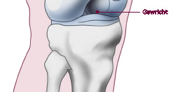 Het bestaat uit twee botdelen: het bovenbeen en het onderbeen. De uiteinden daarvan zijn bedekt met een laag kraakbeen, zodat de knie soepel kan bewegen.