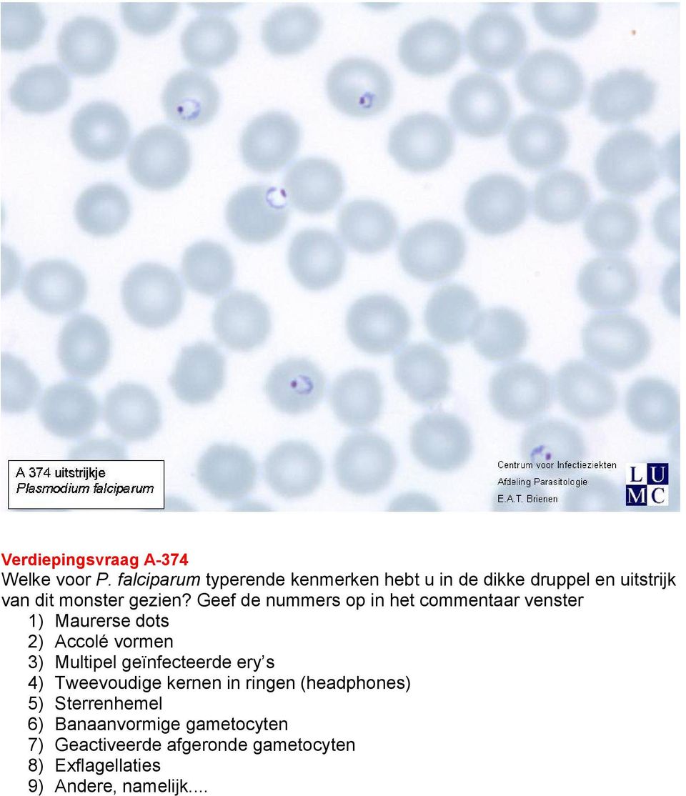 Geef de nummers op in het commentaar venster 1) Maurerse dots 2) Accolé vormen 3) Multipel