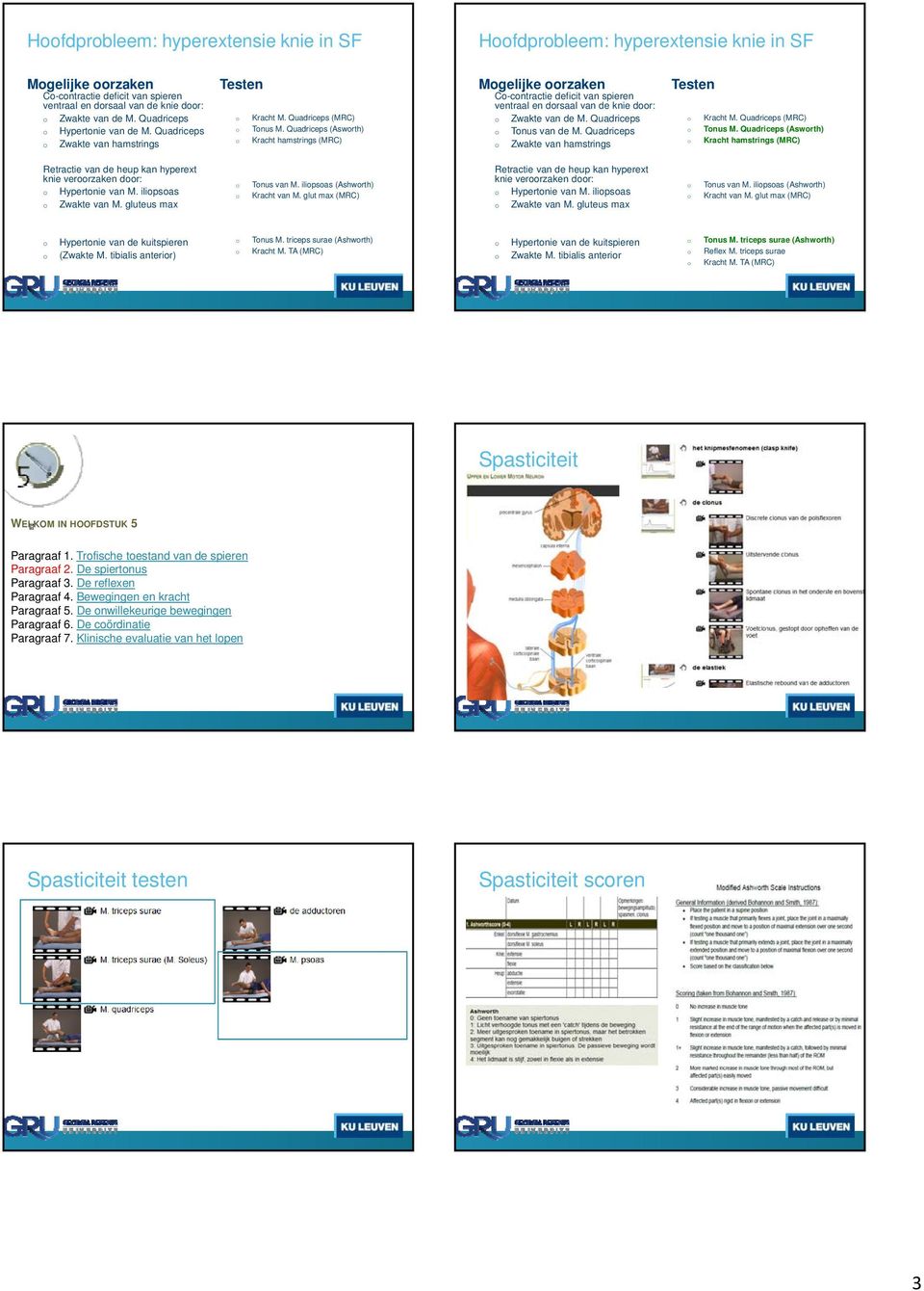 Quadriceps (Aswrth) Kracht hamstrings (MRC) Mgelijke rzaken C-cntractie deficit van spieren ventraal en drsaal van de knie dr: Zwakte van de M. Quadriceps Tnus van de M.