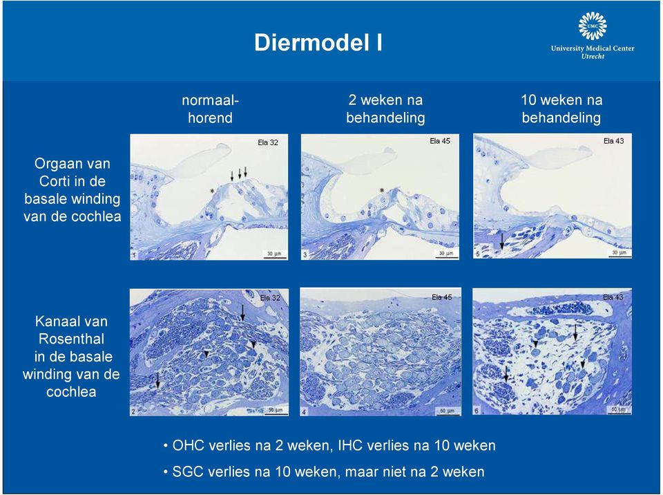 Kanaal van Rosenthal in de basale winding van de cochlea OHC verlies