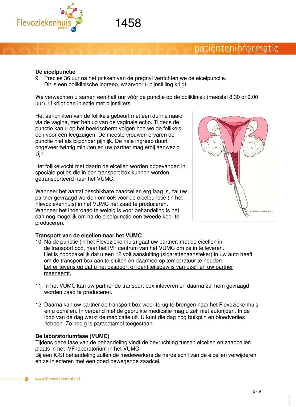 Het aanprikken van de follikels gebeurt met een dunne naald via de vagina, met behulp van de vaginale echo.