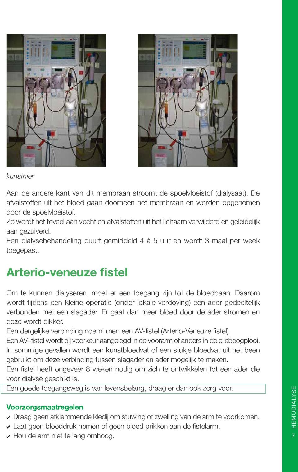 Arterio-veneuze fistel Om te kunnen dialyseren, moet er een toegang zijn tot de bloedbaan.