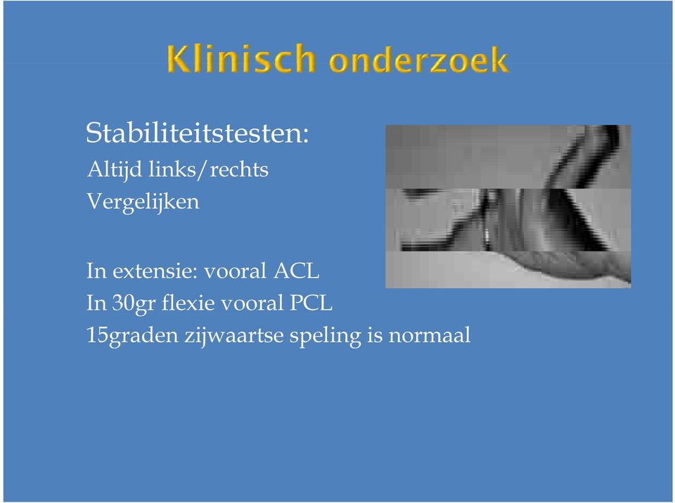 extensie: vooral ACL In 30gr flexie