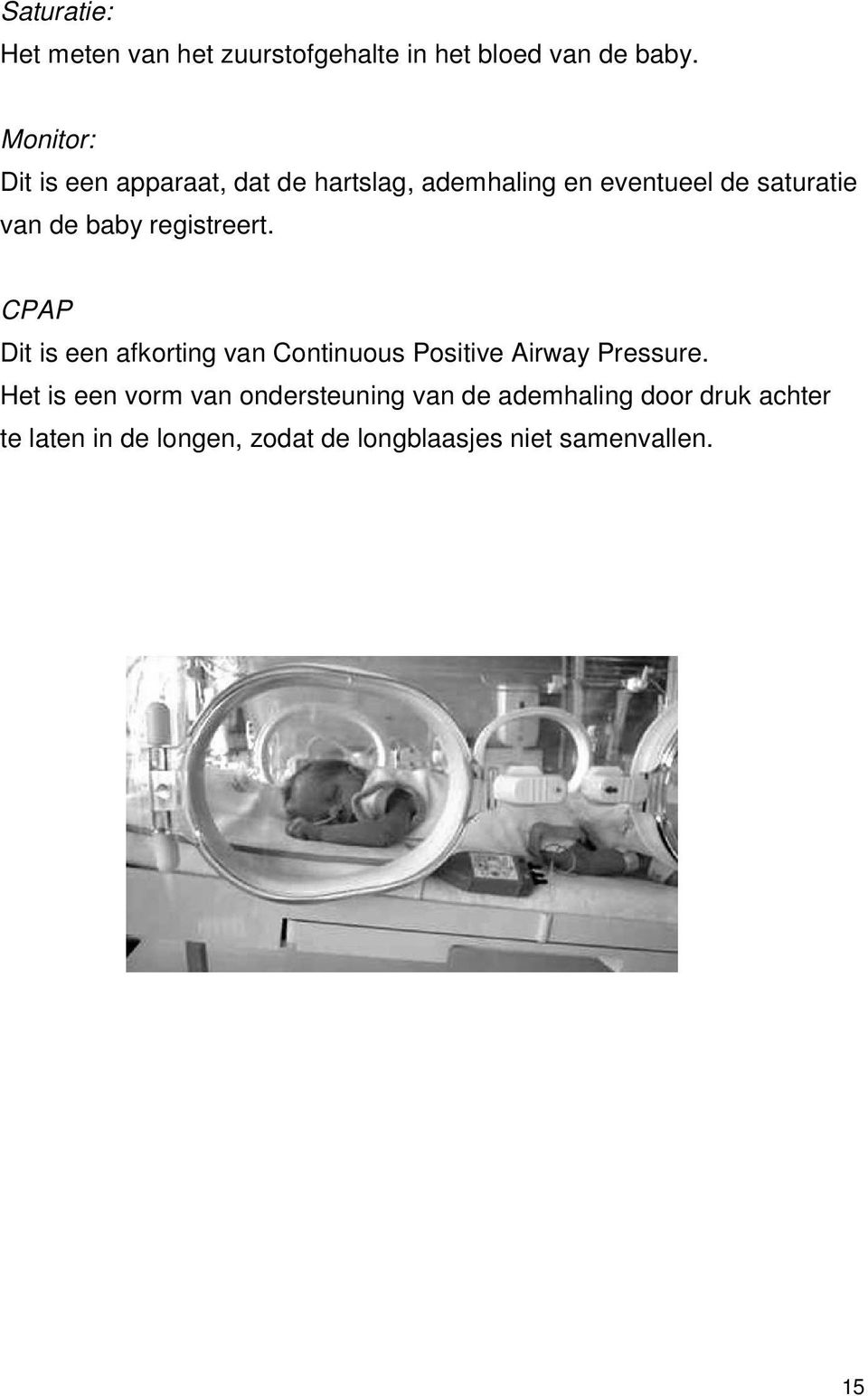 registreert. CPAP Dit is een afkorting van Continuous Positive Airway Pressure.