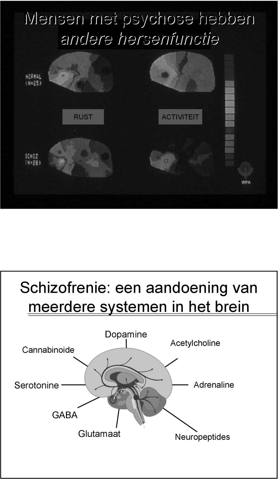 systemen in het brein Cannabinoide Dopamine