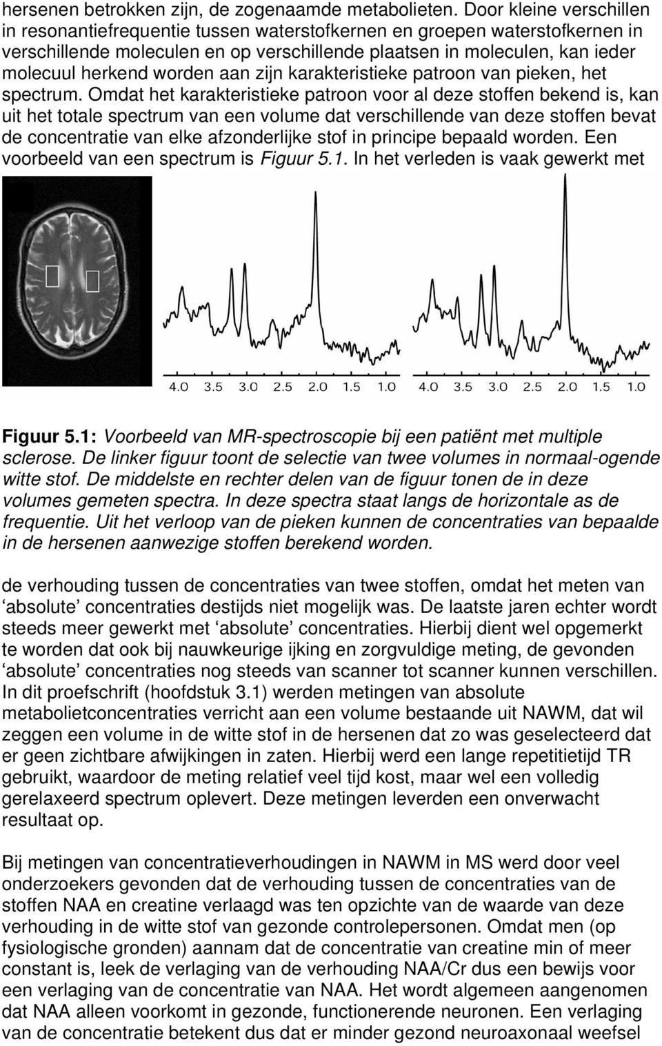 worden aan zijn karakteristieke patroon van pieken, het spectrum.