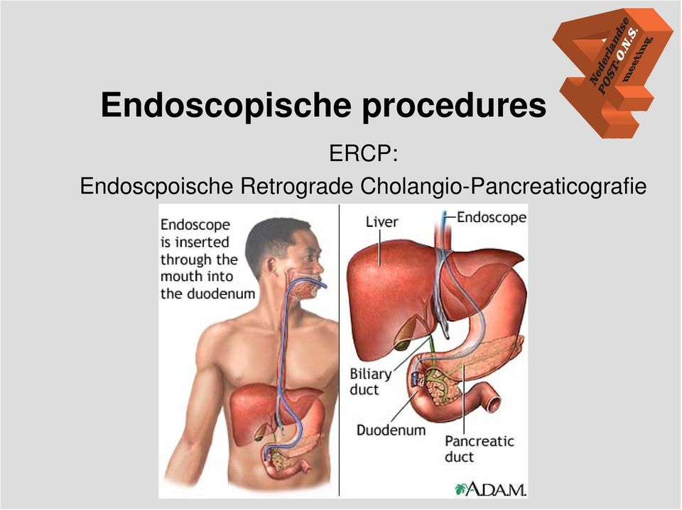 Endoscpoische