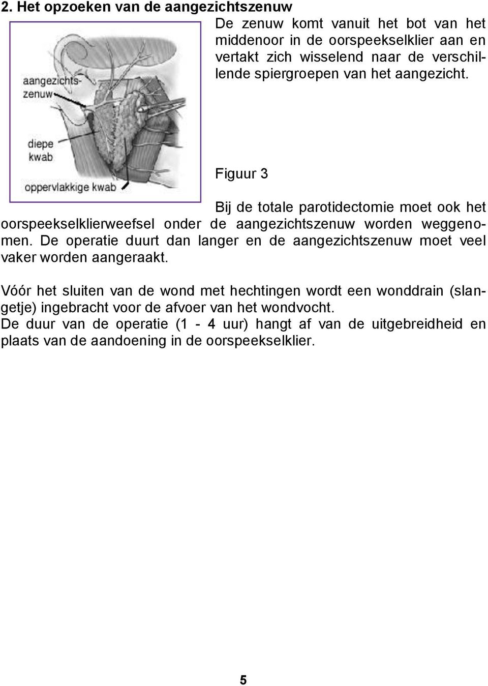 Figuur 3 Bij de totale parotidectomie moet ook het oorspeekselklierweefsel onder de aangezichtszenuw worden weggenomen.