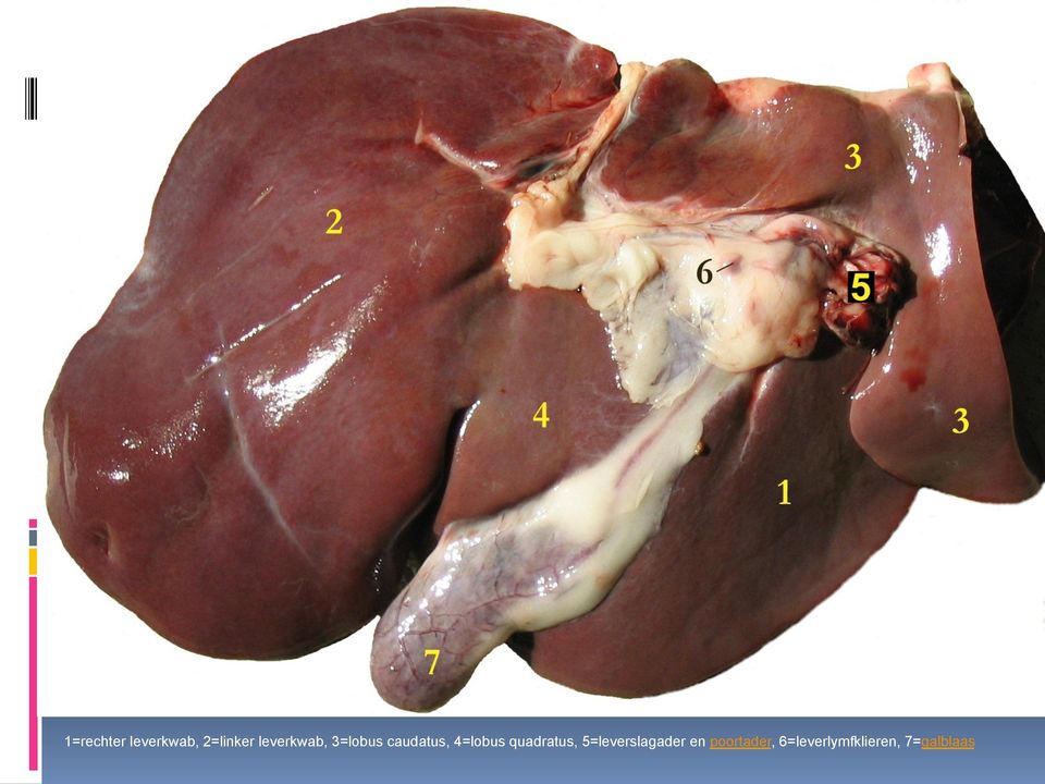 4=lobus quadratus, 5=leverslagader