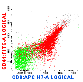 AML-M7 immunofenotype Trombo glycoproteinen: CD41 (glycop.