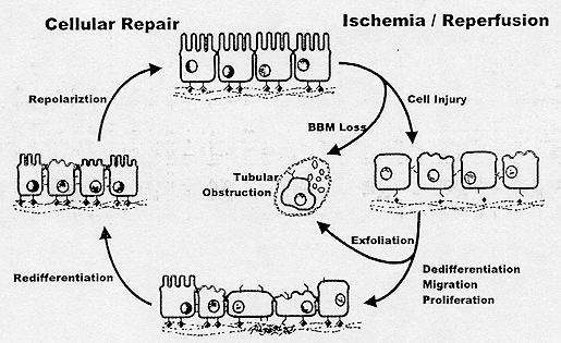 24/11/2010 Acute Renal Failure: still a problem Prerenal causes: 20% Postrenal causes: 5% Intrinsic causes: 75% Tubular necrosis Ischemia: 50% Toxins: 35% Organ Transplantation World War II Korean