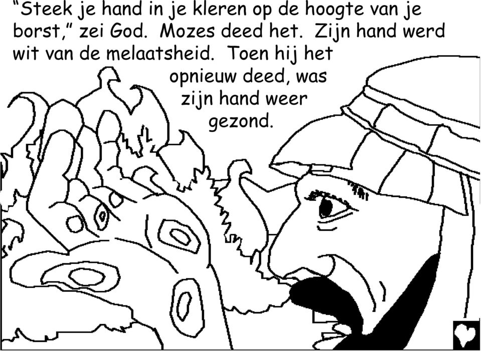 Zijn hand werd wit van de melaatsheid.