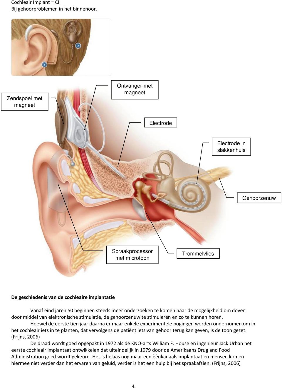 beginnen steeds meer onderzoeken te komen naar de mogelijkheid om doven door middel van elektronische stimulatie, de gehoorzenuw te stimuleren en zo te kunnen horen.