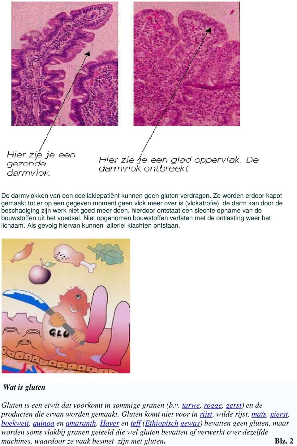 Niet opgenomen bouwstoffen verlaten met de ontlasting weer het lichaam. Als gevolg hiervan kunnen allerlei klachten ontstaan. Wat is gluten Gluten is een eiwit dat voorkomt in sommige granen (b.v. tarwe, rogge, gerst) en de producten die ervan worden gemaakt.