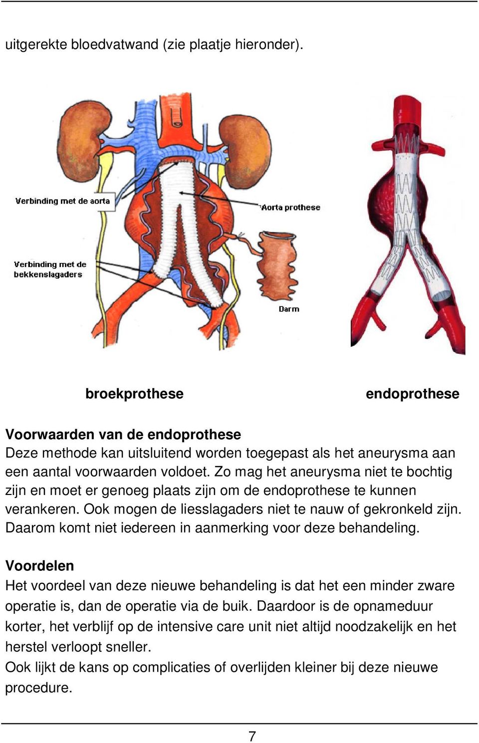 Zo mag het aneurysma niet te bochtig zijn en moet er genoeg plaats zijn om de endoprothese te kunnen verankeren. Ook mogen de liesslagaders niet te nauw of gekronkeld zijn.