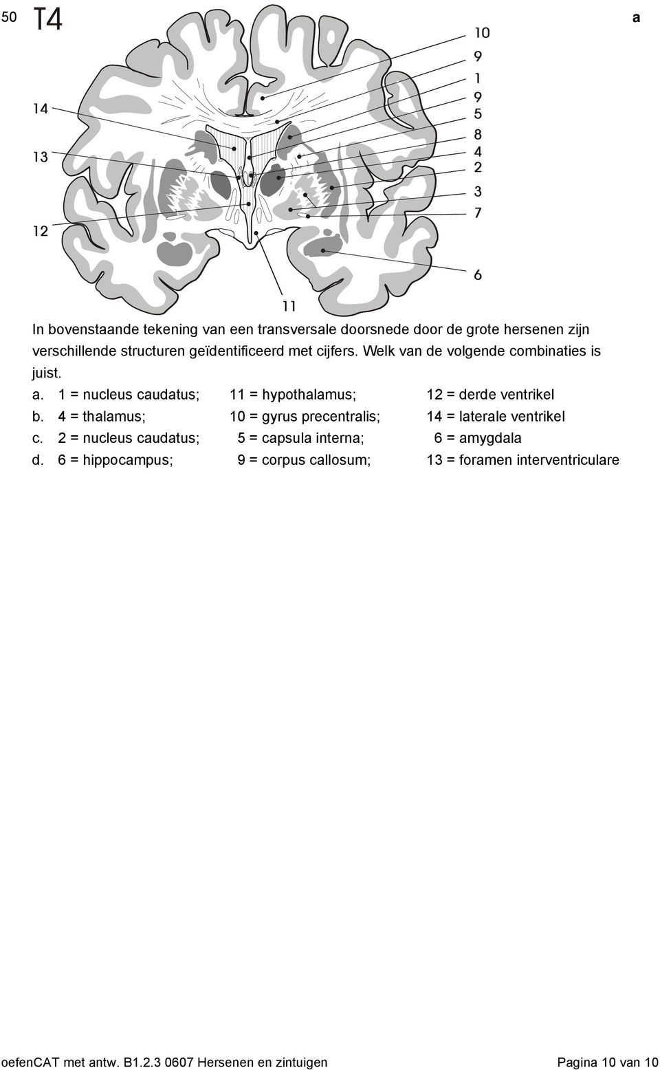 4 = thlmus; 10 = gyrus preentrlis; 14 = lterle ventrikel. 2 = nuleus utus; 5 = psul intern; 6 = mygl.