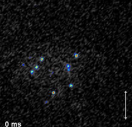 Microscopie Single-molecule (1) Fluorescentiemicroscopie aan 1 molecuul: - sub-diffractie resolutie: centrum airy-schijf telt -