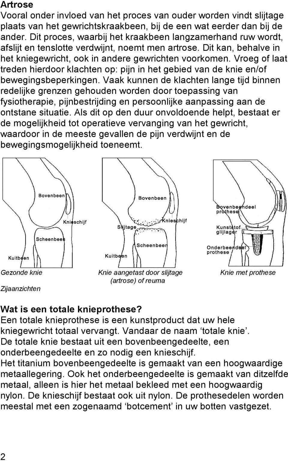 Vroeg of laat treden hierdoor klachten op: pijn in het gebied van de knie en/of bewegingsbeperkingen.