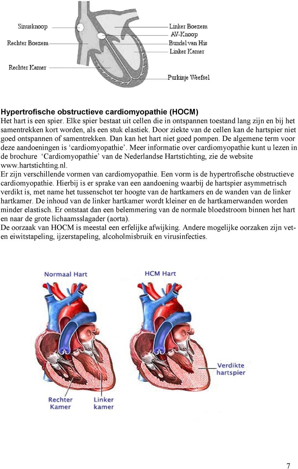 Meer informatie over cardiomyopathie kunt u lezen in de brochure Cardiomyopathie van de Nederlandse Hartstichting, zie de website www.hartstichting.nl.