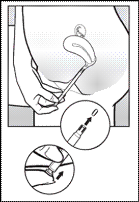 1. Scheur één enkele blisterverpakking los. Open het uiteinde zoals aangegeven in de afbeelding. 2. Breng de applicator voorzichtig in de vagina. Stop wanneer u wat weerstand voelt (na 8-10 cm). 3.